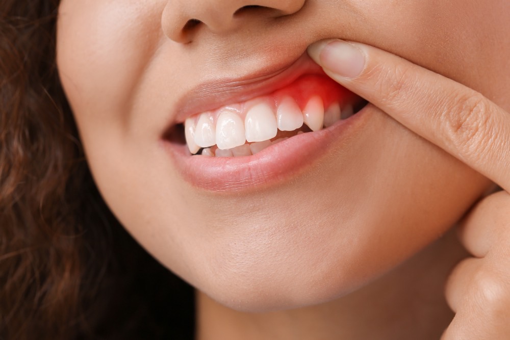 Periodontal Dental Care Droitwich Spa