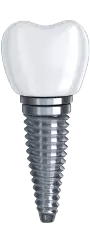 post5-compress Dental Implant