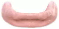 Replace all missing teeth